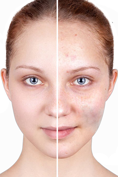 Photo Retouching